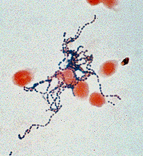 S. pyogenes